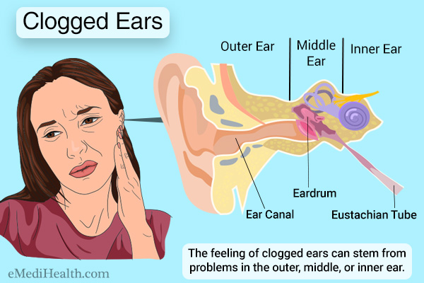 Icd 10 Code For Middle Ear Effusion