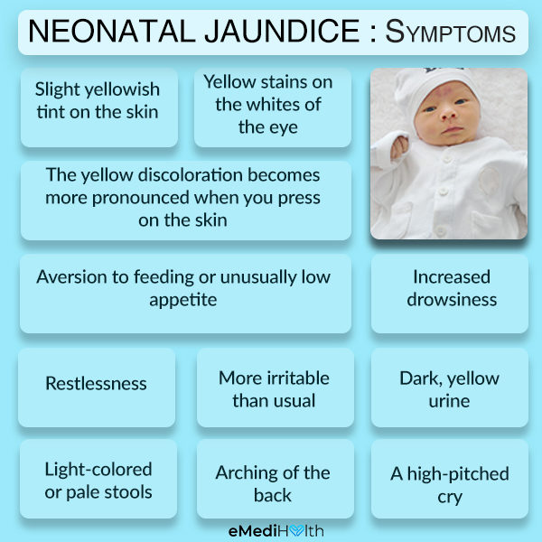 Symptoms of neonatal jaundice