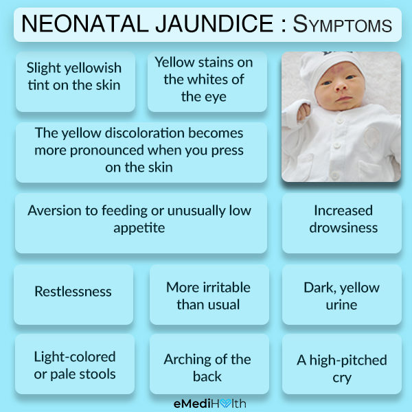 essay on neonatal jaundice