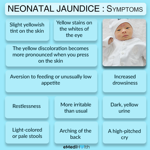 Neonatal Jaundice Symptoms