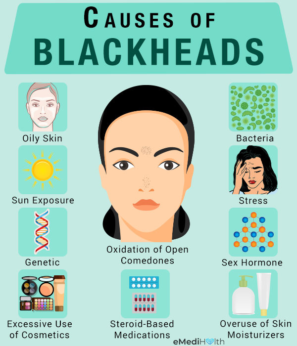 How To Clear Blackheads Home Remedies And Treatment