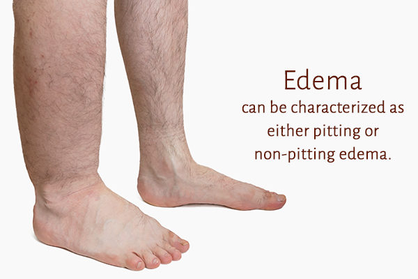 4+ pitting edema