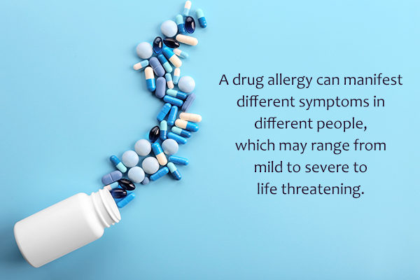 certain drugs and medications can trigger an allergy