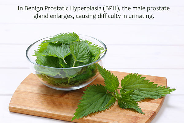 stinging nettle may help relieve benign prostatic hyperplasia