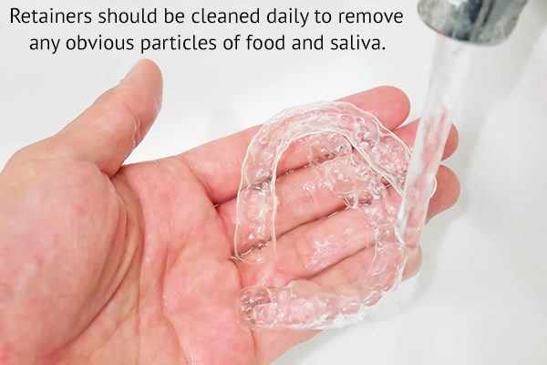proper way of cleaning retainers