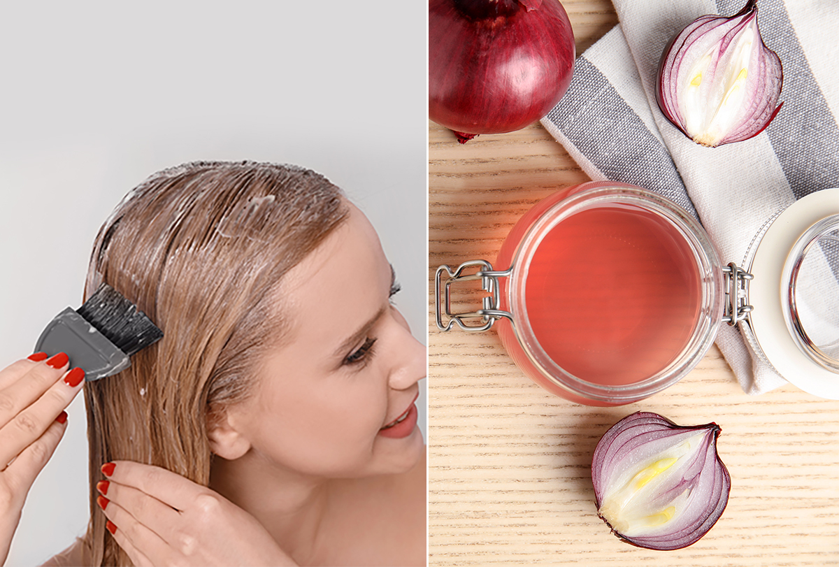 Onion/Shallot Juice for Hair: Benefits & How to Make