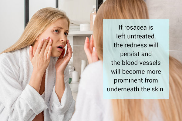 complications of untreated rosacea