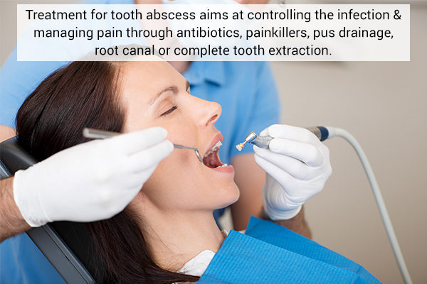 medical treatment for tooth abscess