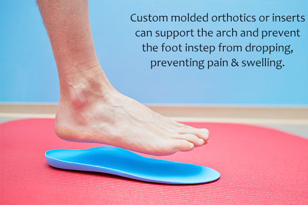 non-surgical treatment options for flatfoot