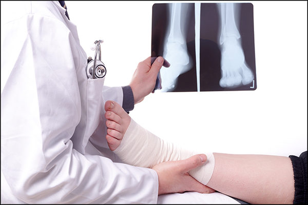 ankle replacement surgery procedure