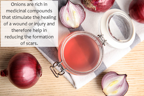 onions may aid in the treatment of scars