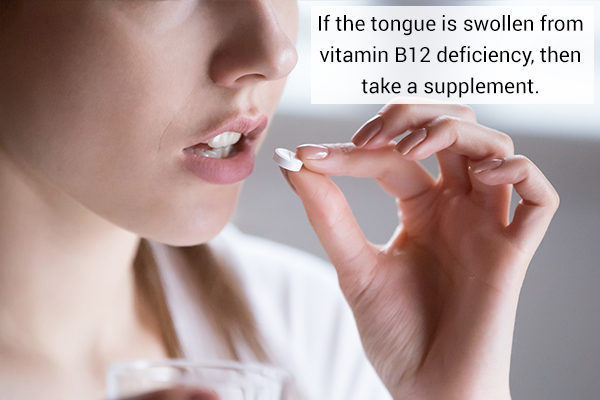 treatments for swollen tongue