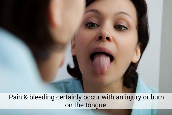 signs that indicate a swollen tongue