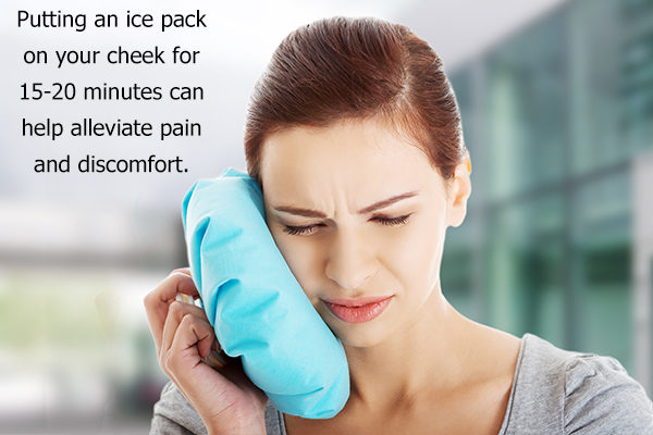 application of ice pack can relieve wisdom tooth pain