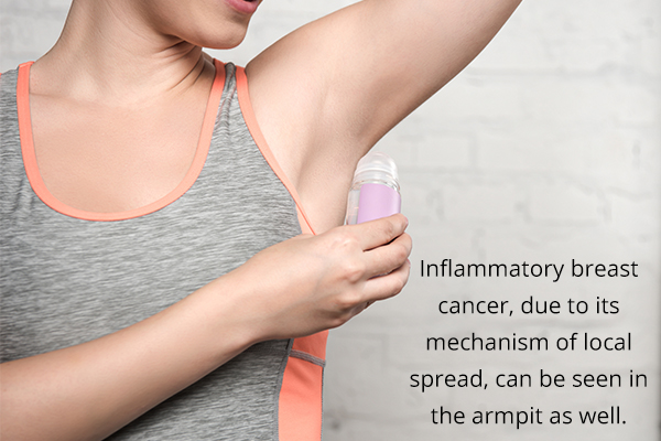 is armpit itching an indication of a severe problem?