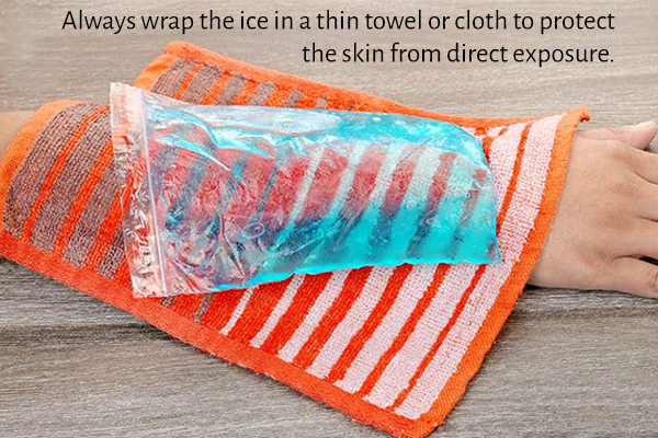 mistakes to avoid when icing an injury