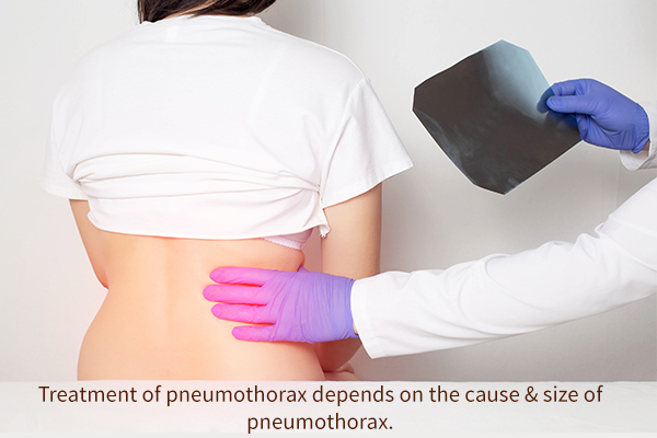 treatment and diagnosis for pneumothorax