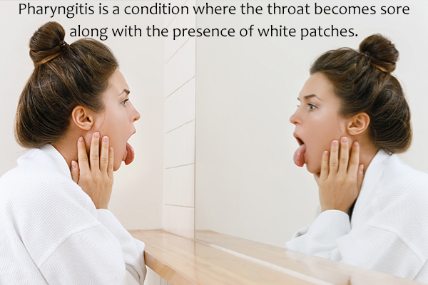 what causes white spots in the throat?