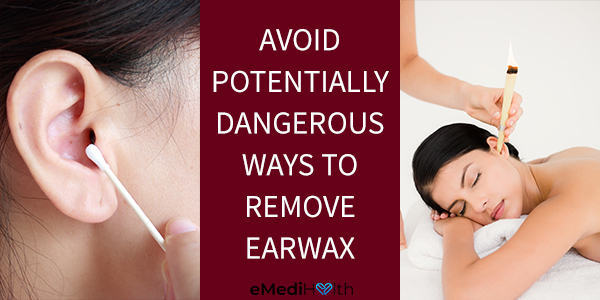 avoid invasive methods to clean earwax buildup
