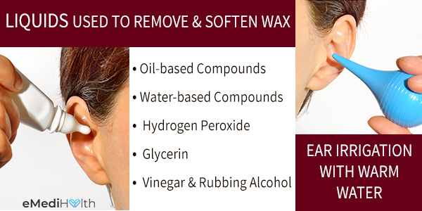 Home Remedy For Ear Wax Removal