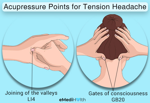 try acupressure to relieve tension headache