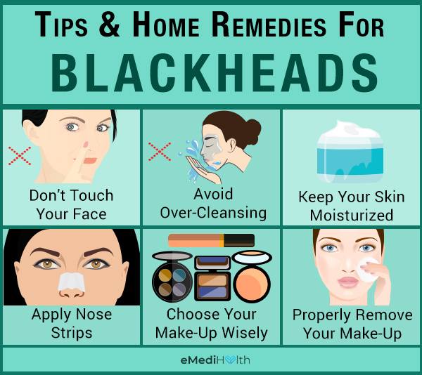 How To Get Rid Of Blackheads At Home Emedihealth