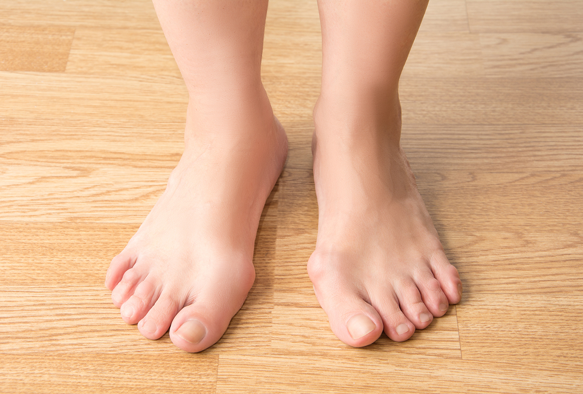 home therapies to manage bunions