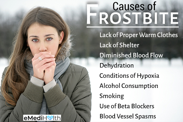 what causes frostbite?