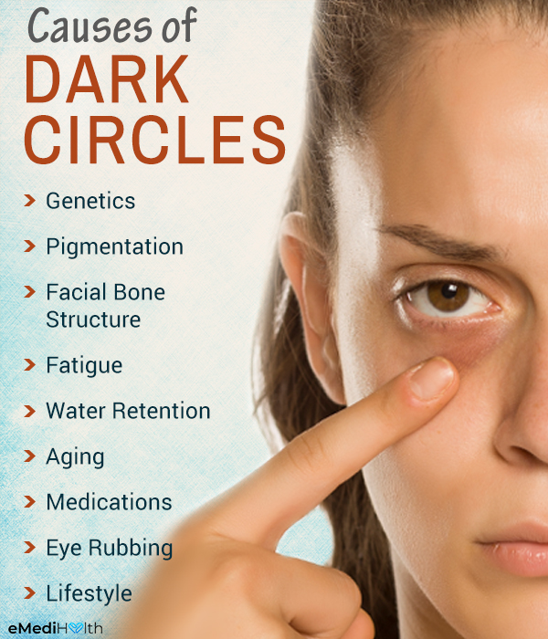 what causes dark circles under the eyes?