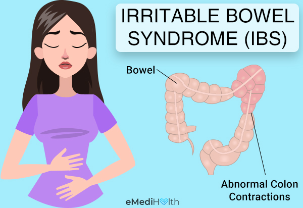 types of ibs
