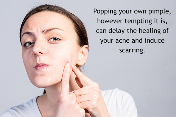 popping your pimple at home can damage your skin