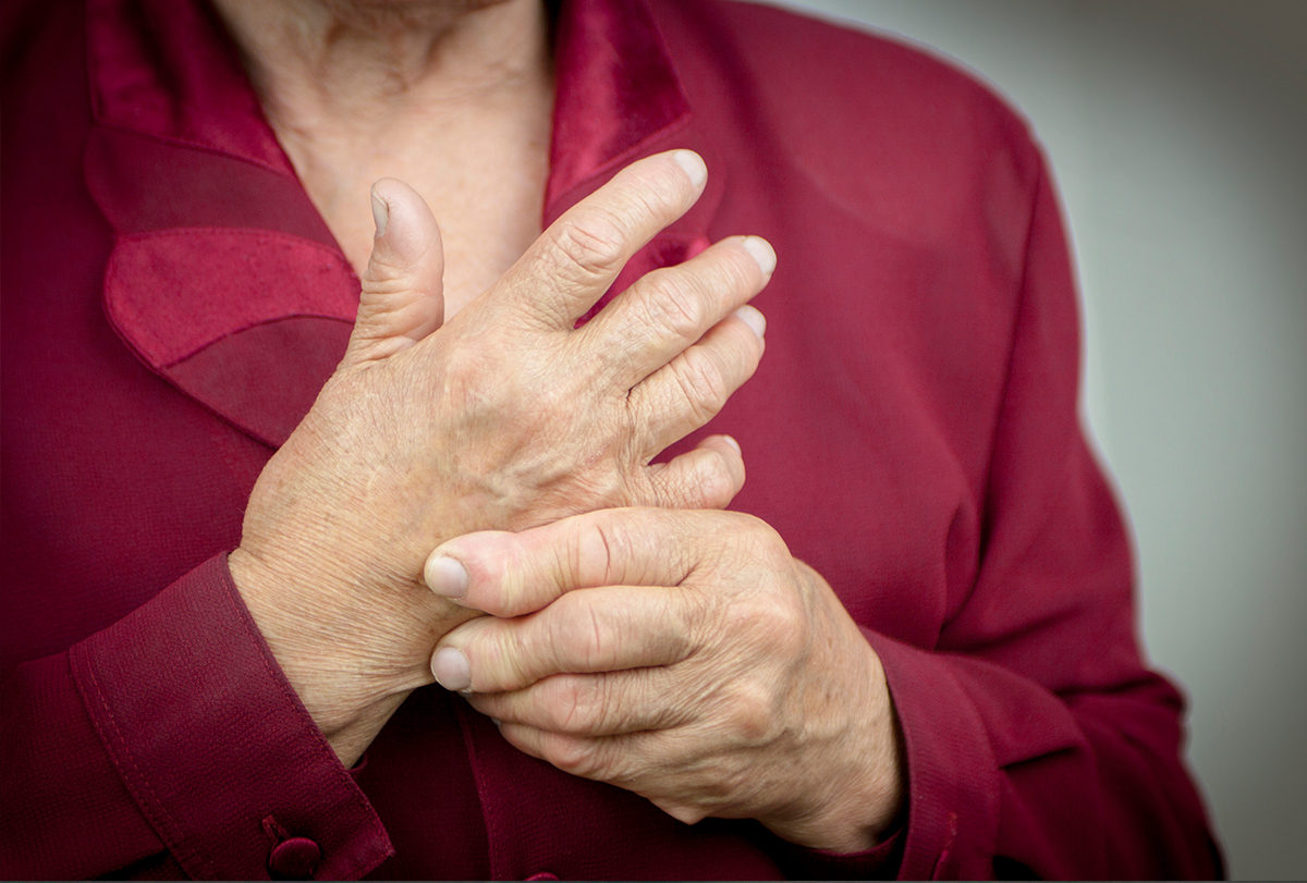 rheumatoid arthritis