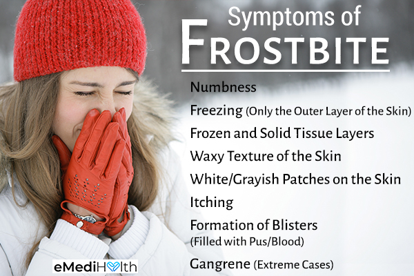 signs and symptoms of frostbite