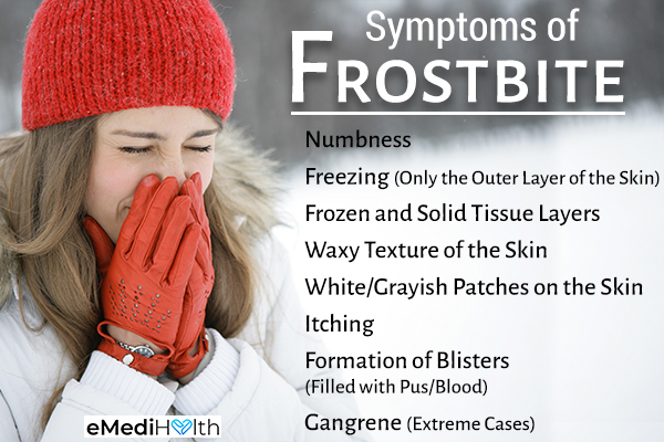 What Is Another Name For Frostbite