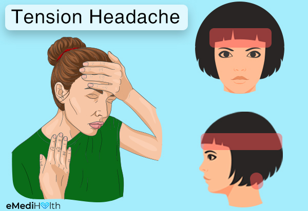 what-causes-tension-headaches-and-how-to-treat-them