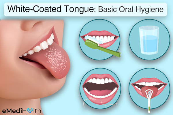 self-care tips to prevent white-coated tongue