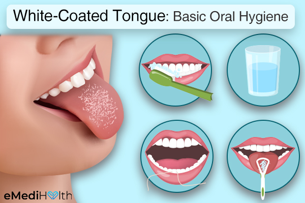 Tips For White Coated Tongue 