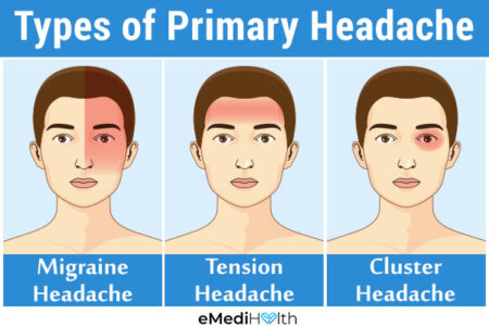 Different Types of Headaches & When to See a Doctor