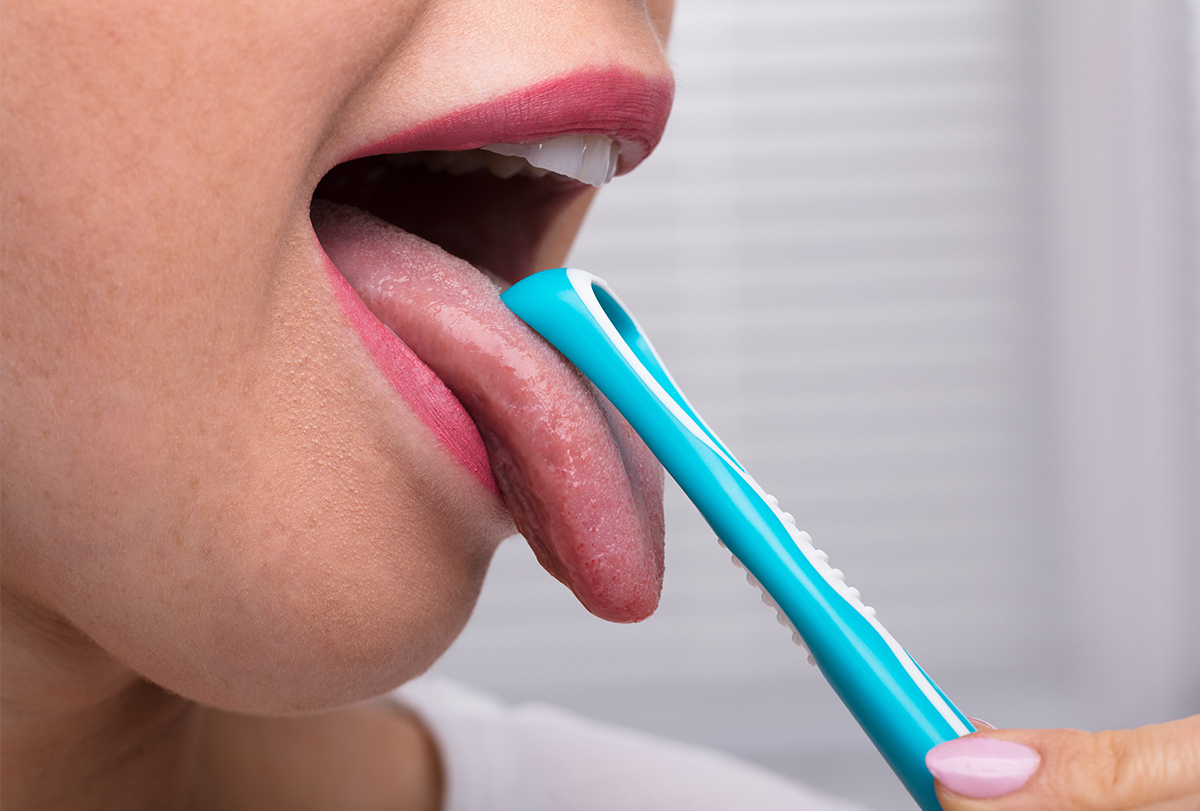 How To Get Rid Of White On Tongue