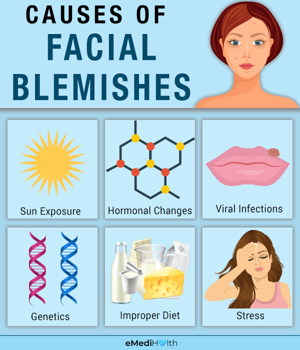 facial-blemishes-causes-types-and-treatment-emedihealth