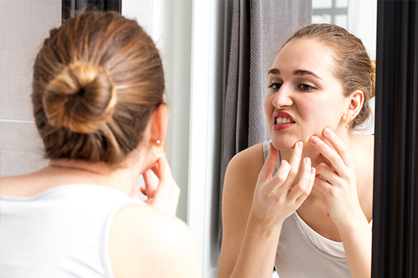 experts advice on ways to relieve blemishes
