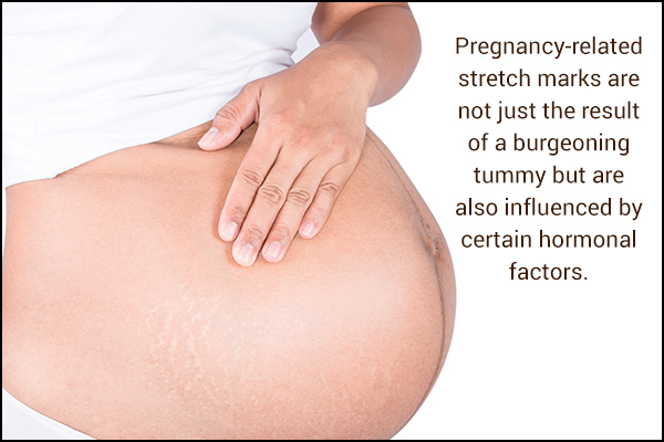 what causes stretch marks during pregnancy?