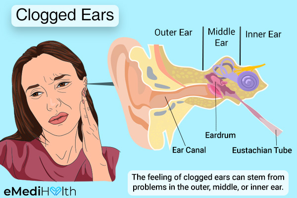 factors that can lead to clogged ears