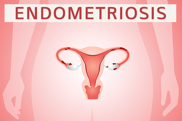 causes of endometriosis