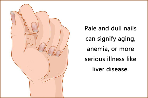 causes of pale and dull nails