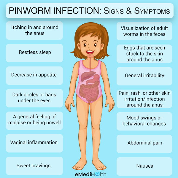 symptoms of a pinworm infection