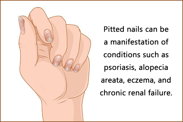 reasons for pitted nails