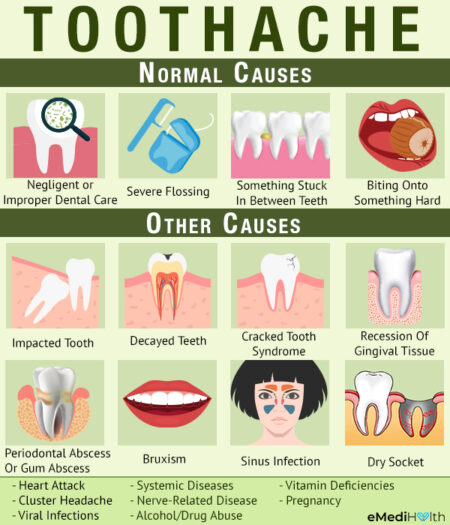 Toothache 101 Causes And Treatment EMediHealth