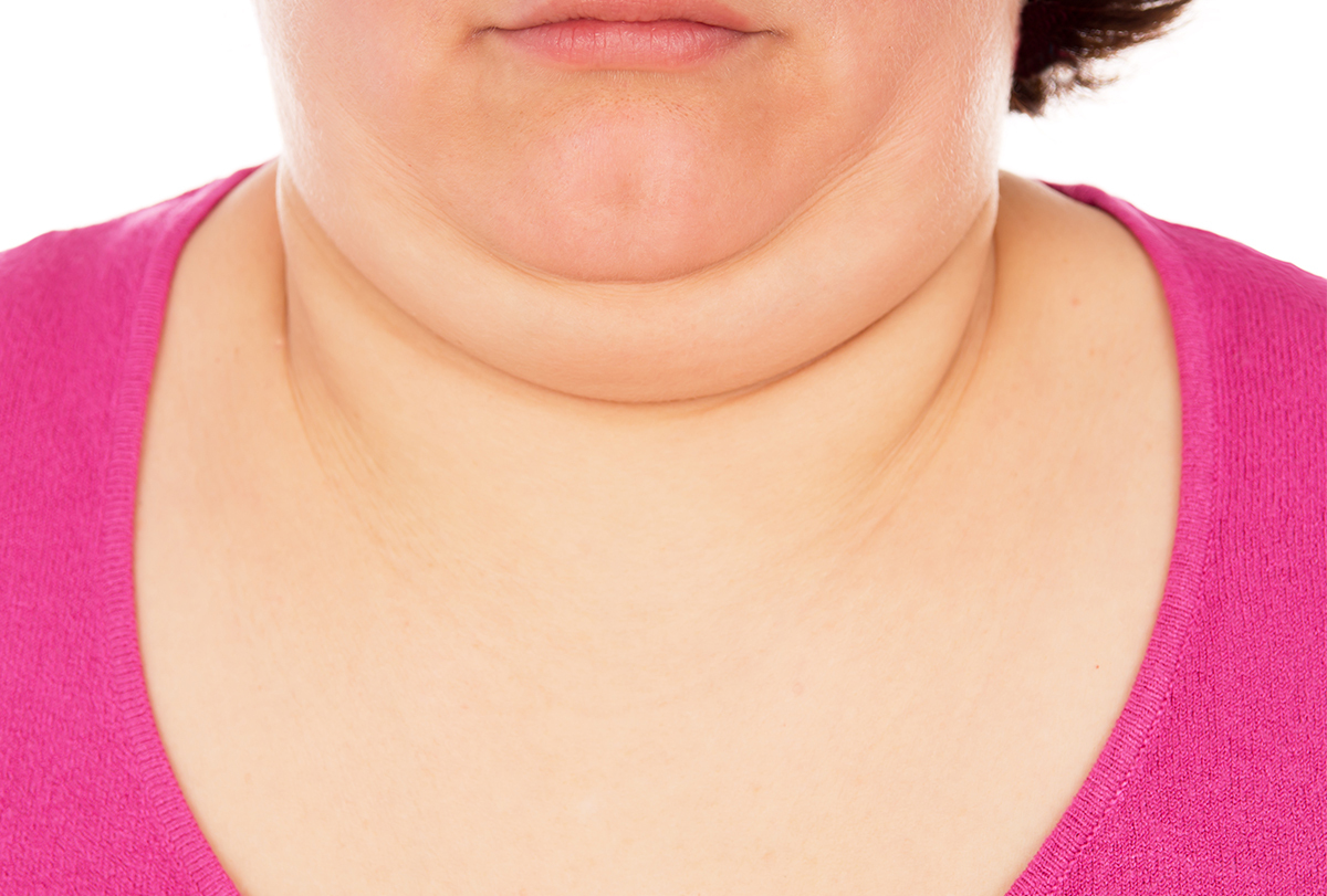 measures to reduce double chin