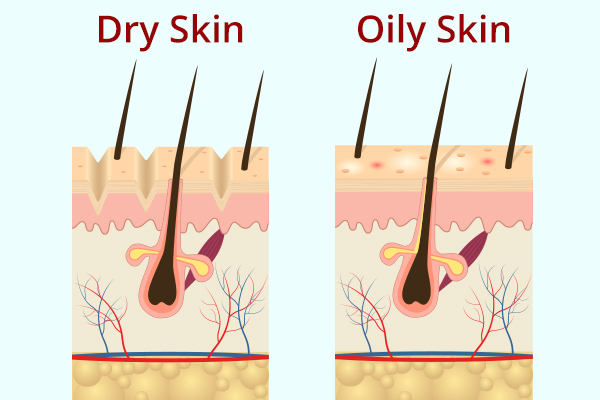 dry skin versus oily skin